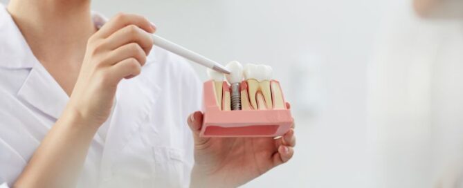 Dental Implants: What Are They & How Do They Work?