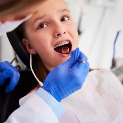 The Different Types of Orthodontic Treatments