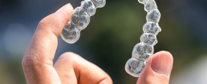 Everything You Need To Know About Invisalign