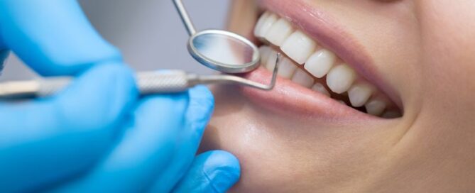 4 Cosmetic Solutions To Fix the Appearance of Small Teeth