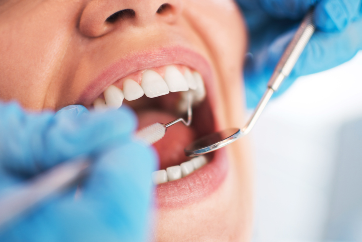 In Safe Hands: Choosing the Right Oral Surgeons in Los Angeles