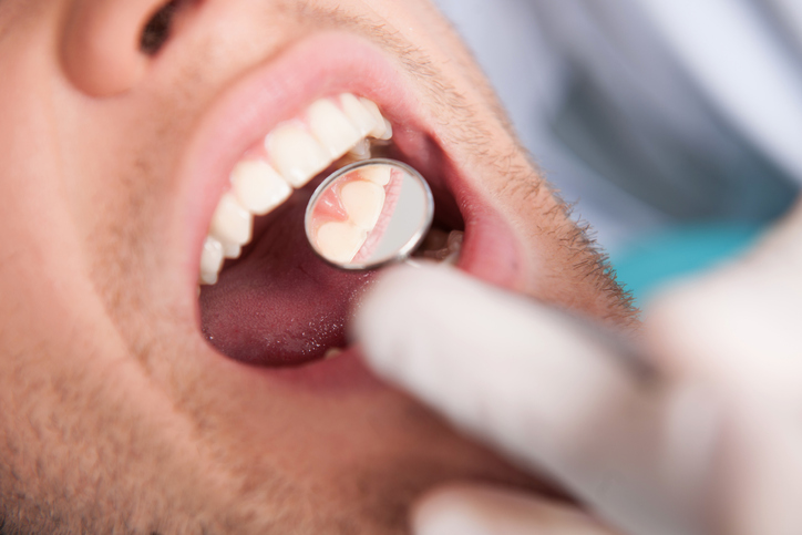 Gum Disease Examination​