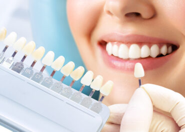What is a cosmetic dentist, and what services do they offer?