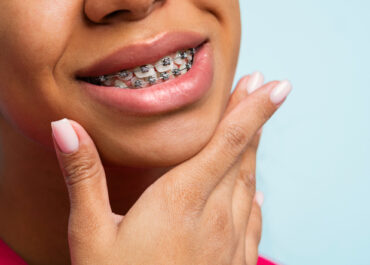 How to Take Care of Dental Hygiene with Braces?